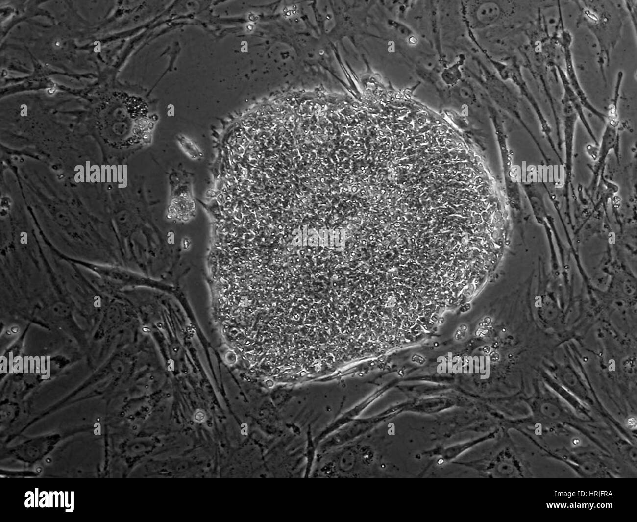 Human Embryonic Stem Cell Line BG03 Stock Photo