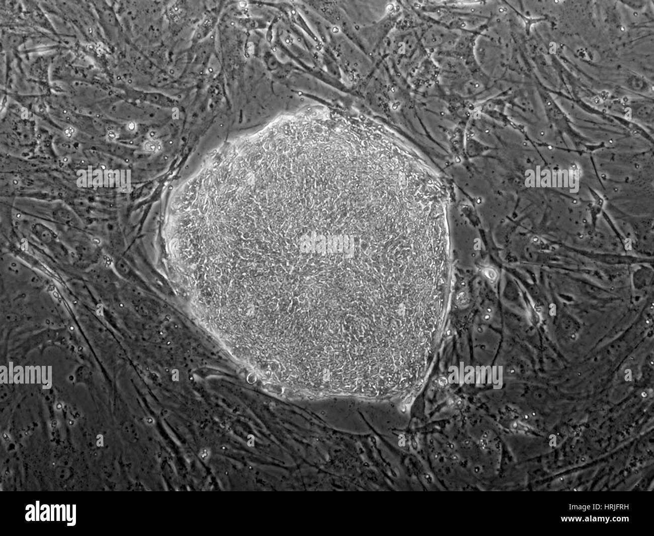 Human Embryonic Stem Cell Line ES03 Stock Photo