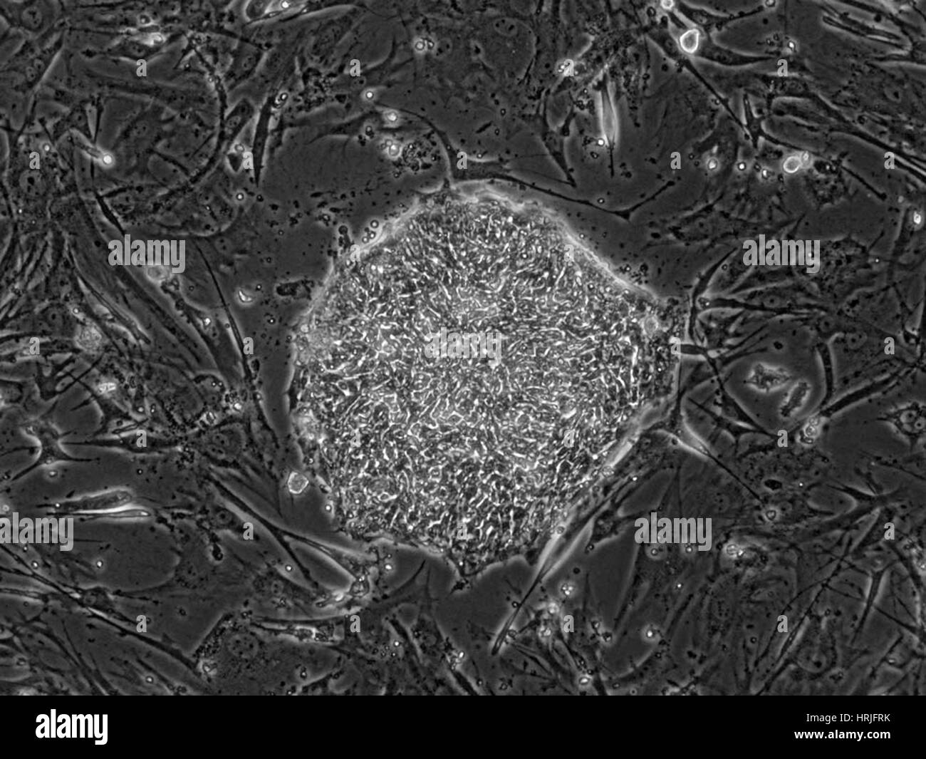 Human Embryonic Stem Cell Line ES06 Stock Photo