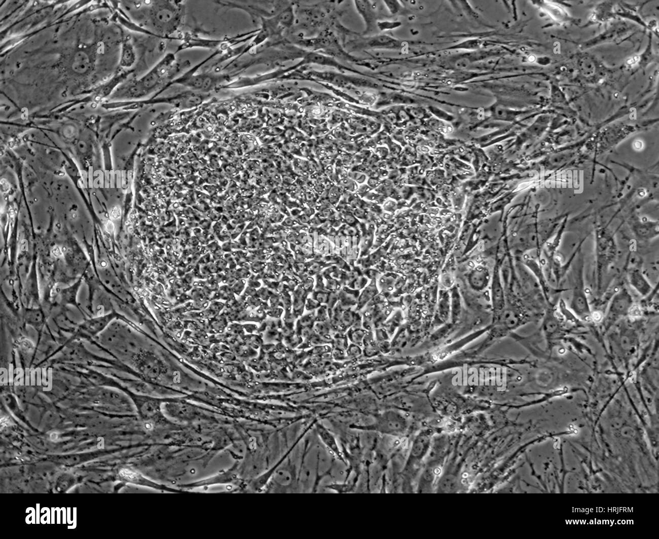 Human Embryonic Stem Cell Line SA01 Stock Photo