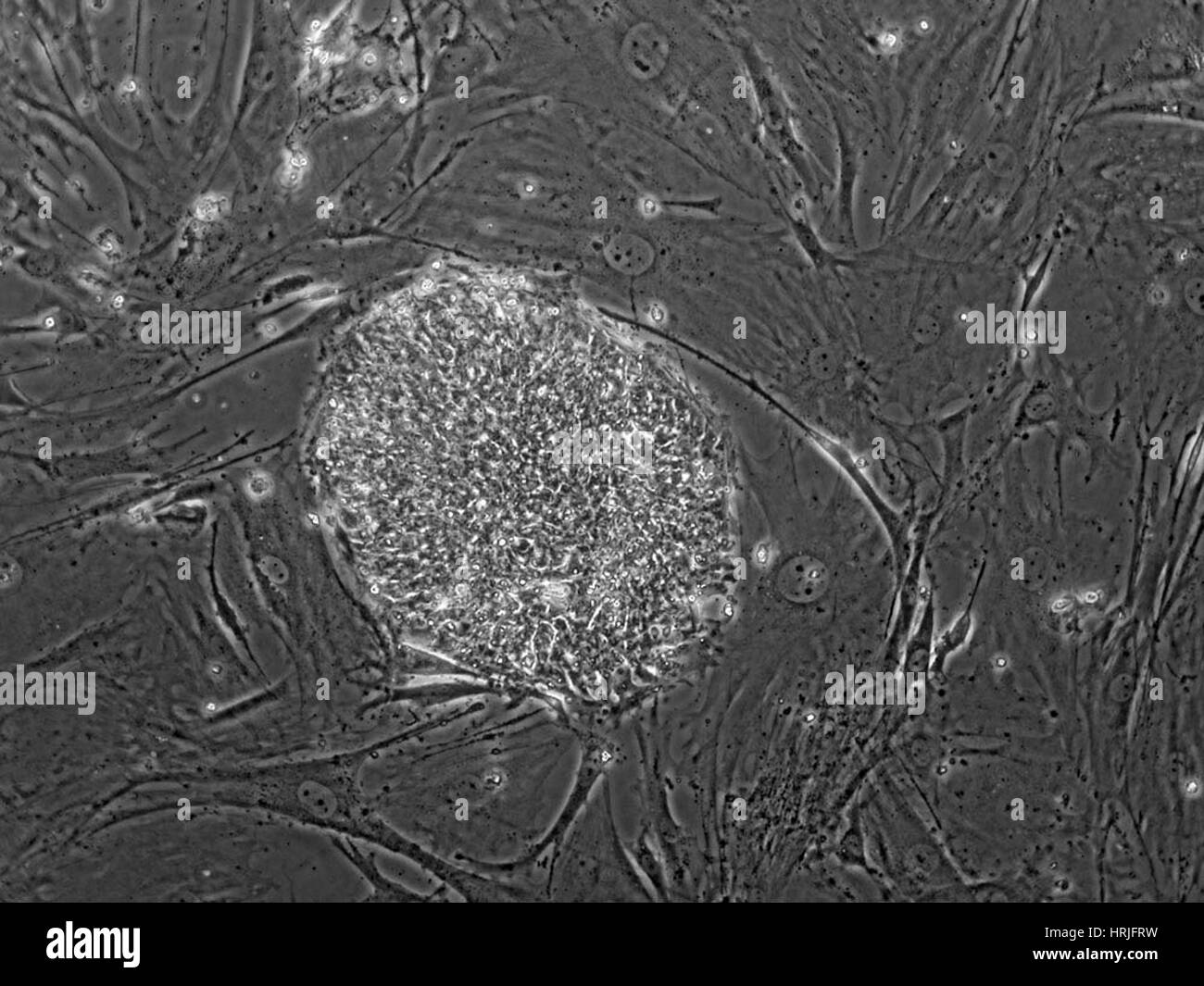 Human Embryonic Stem Cell Line TE06 Stock Photo