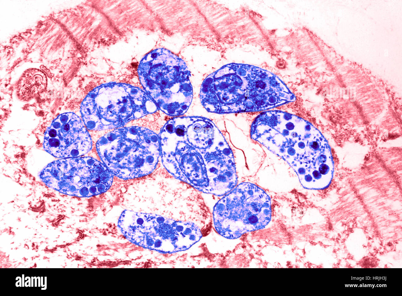 Токсоплазмоз легких. Кониофаг. Гидроцефалия токсоплазмоз. Токсоплазмоз легких. Токсоплазмоз легких.