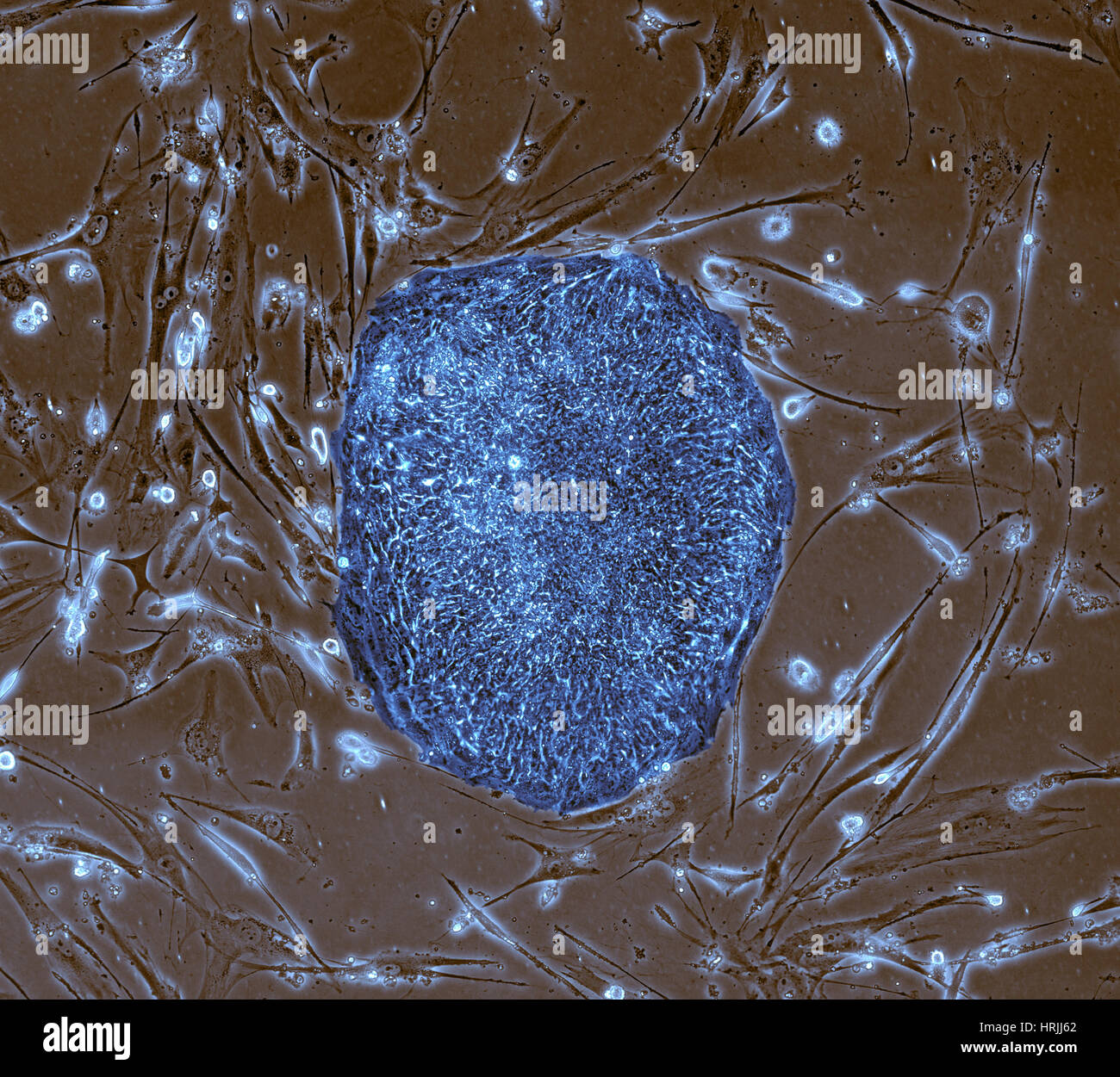 Human Induced Pluripotent Stem Cells, LM Stock Photo Alamy