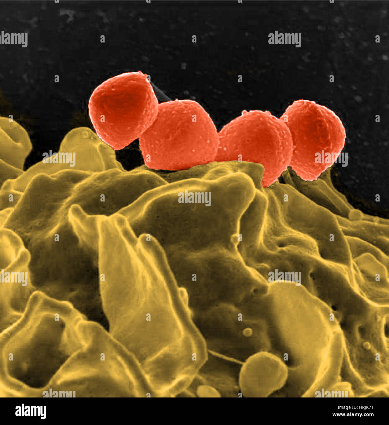 Streptococcus pyogenes bacteria sem hi-res stock photography and images ...