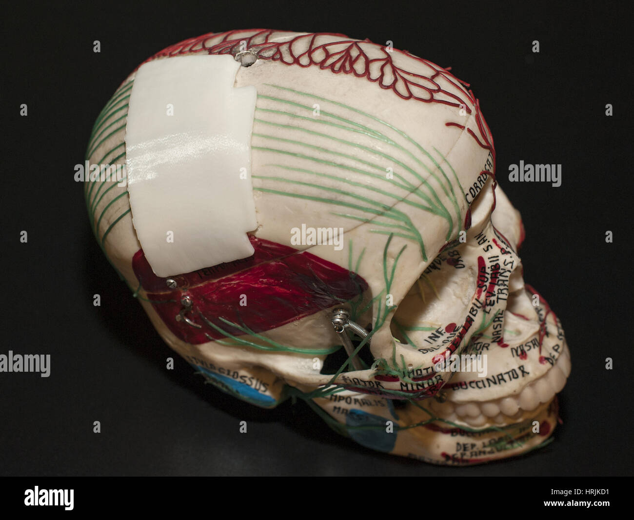 3-D Printed Skull Plate, 2015 Stock Photo
