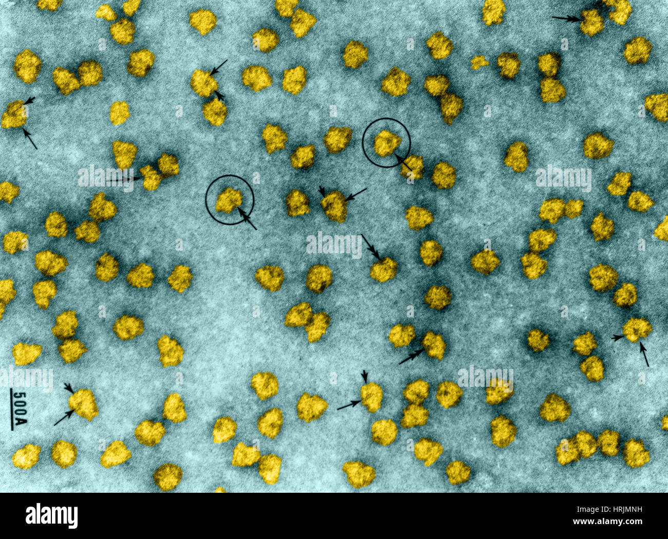 Ribosome electron micrograph hi-res stock photography and images - Alamy