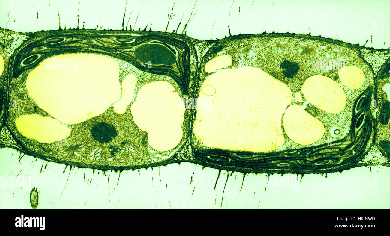 В клетках водорослей содержится. Клетки водорослей под микроскопом. Клетки ламинарии под микроскопом. Клетки водорослей в микроскопе. Клеточная стенка под микроскопом.