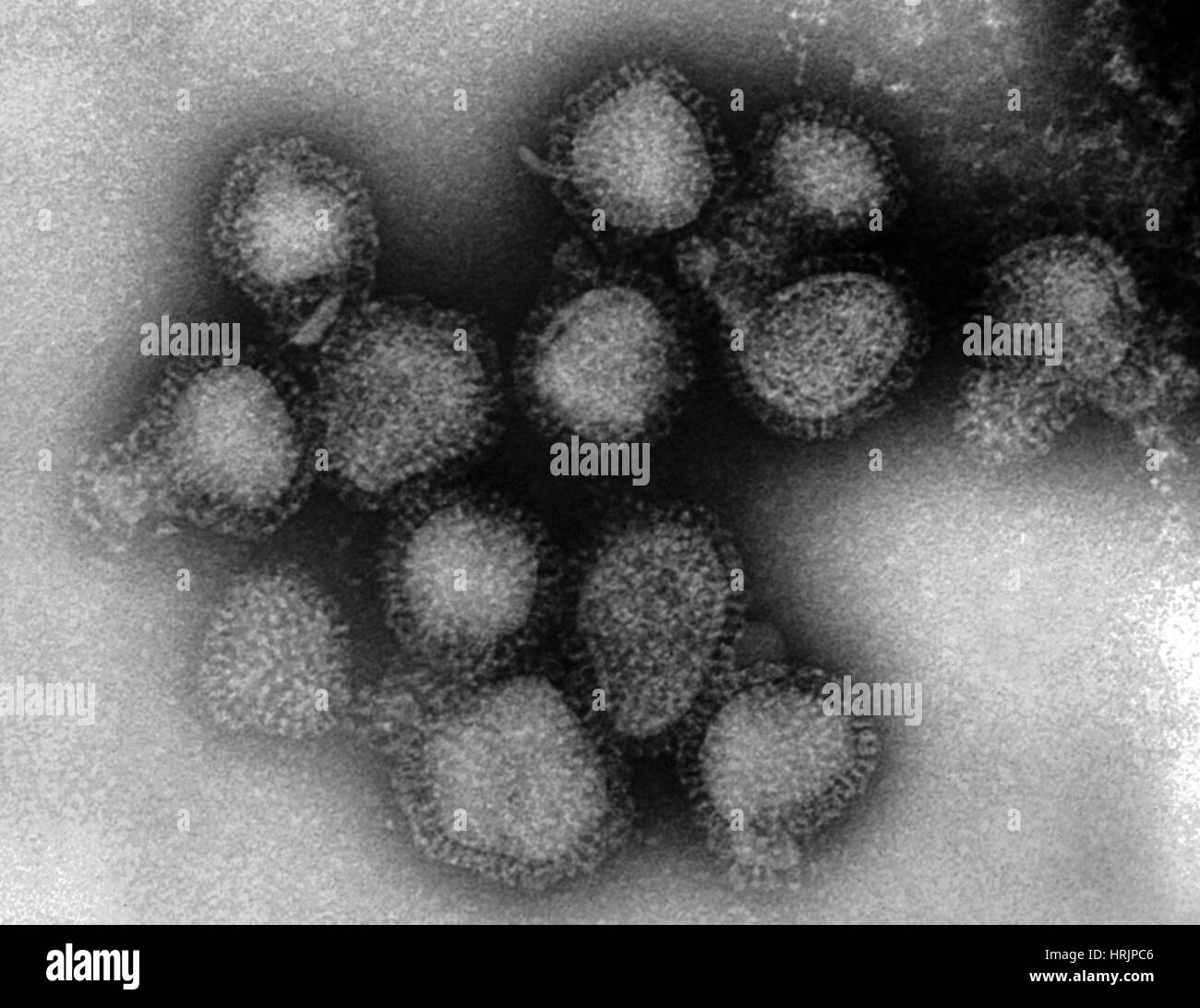 hong-kong-flu-virus-tem-HRJPC6.jpg