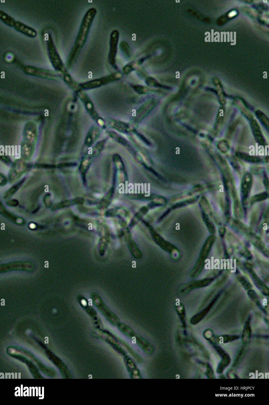 Anthrax, Bacillus anthracis Bacteria, LM Stock Photo