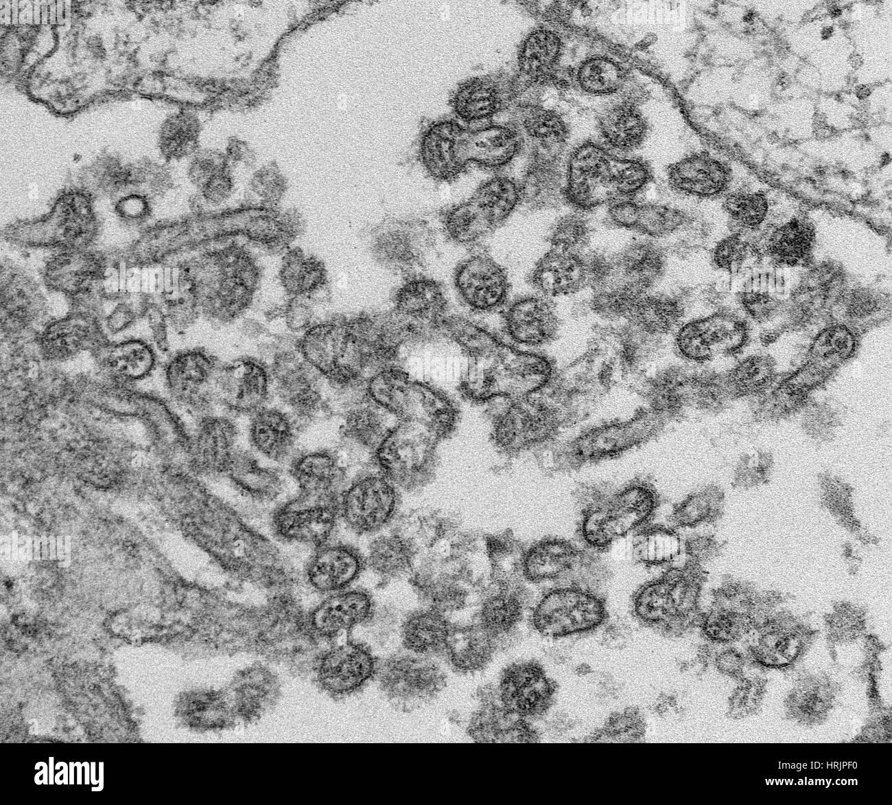 Bourbon Virus, TEM Stock Photo