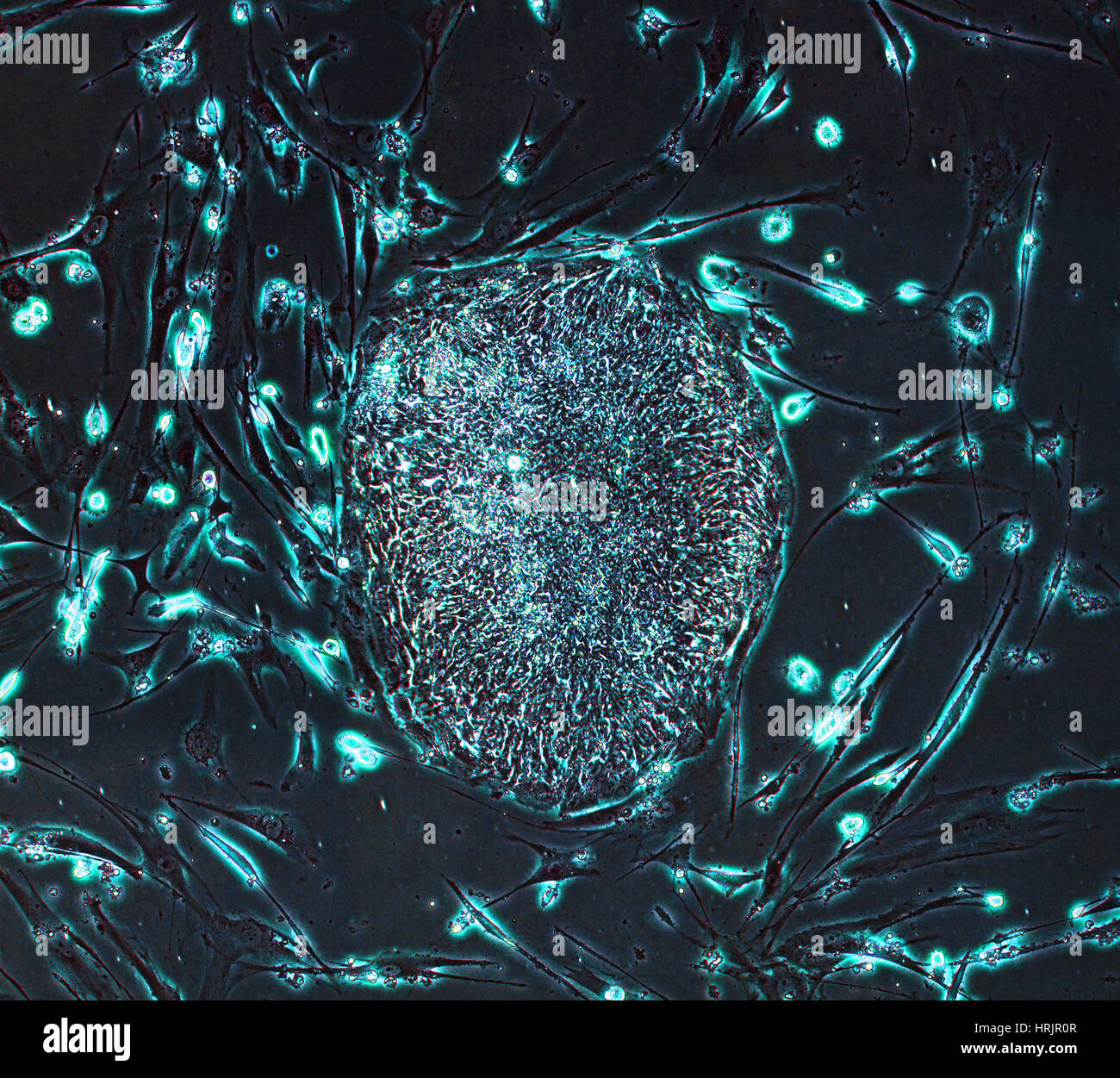 Human Induced Pluripotent Stem Cells, LM Stock Photo Alamy