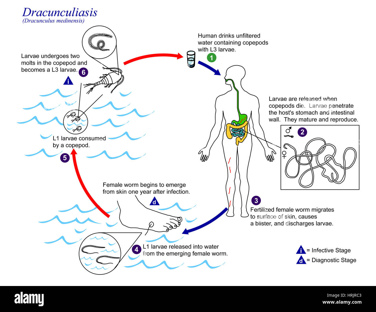 Dracunculus medinensis, Guinea Worm Life Cycle Stock Photo