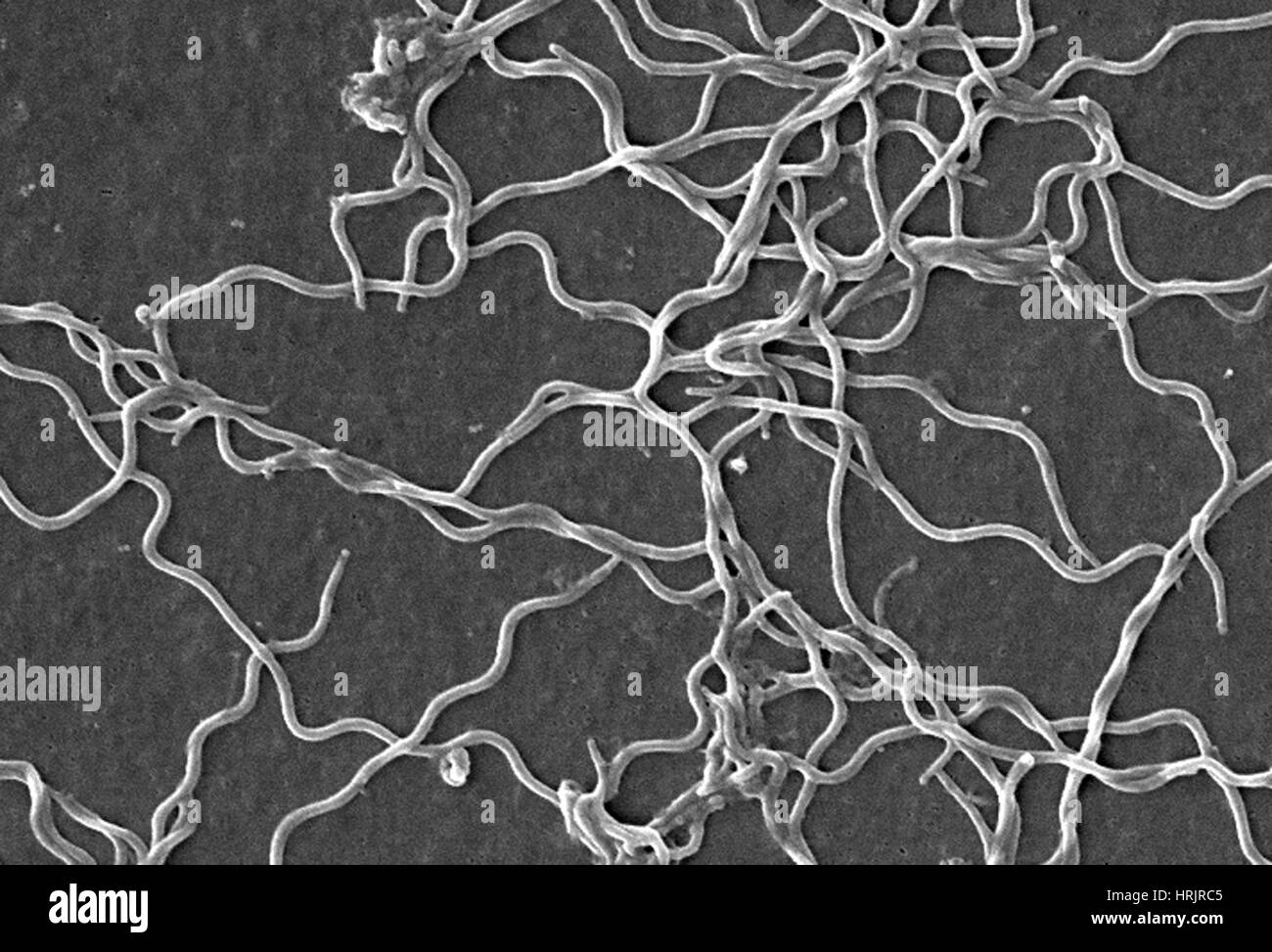 Lyme Disease, Borrelia burgdorferi Bacteria, SEM Stock ...