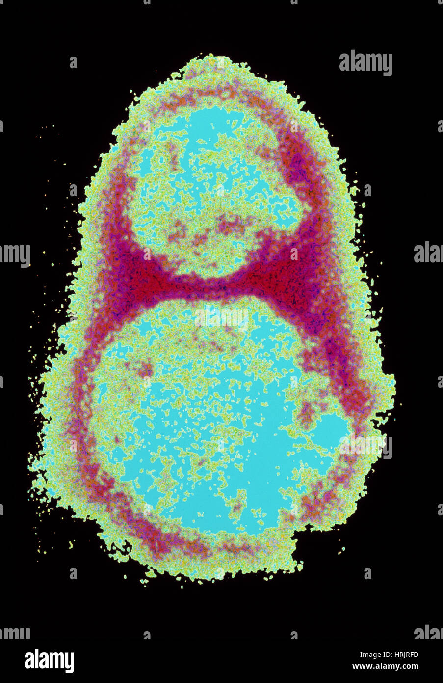 Hantavirus, TEM Stock Photo