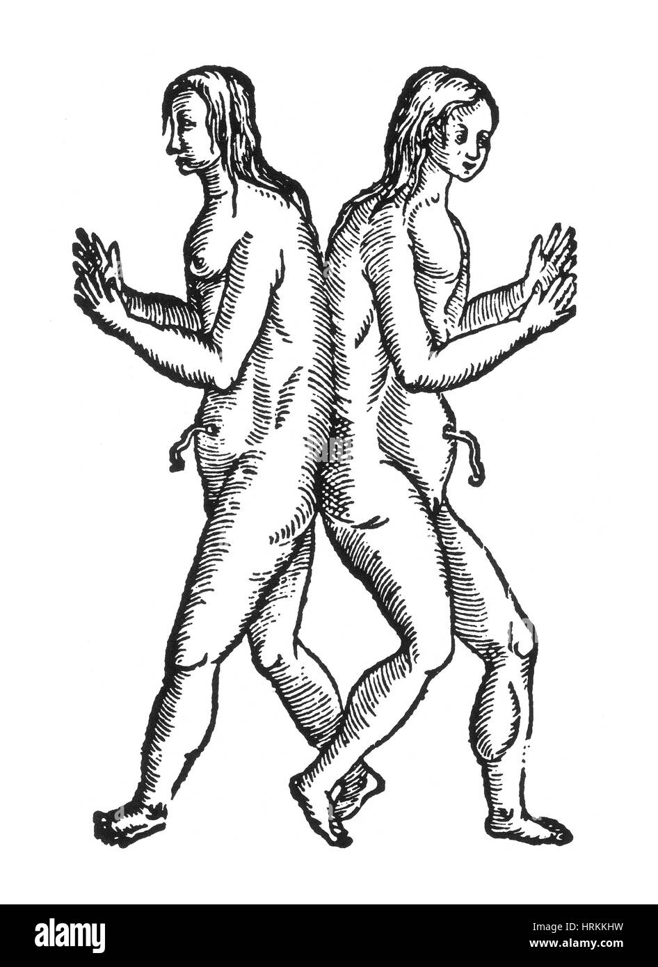 Raciphagus Conjoined Twins, 16th Century Stock Photo