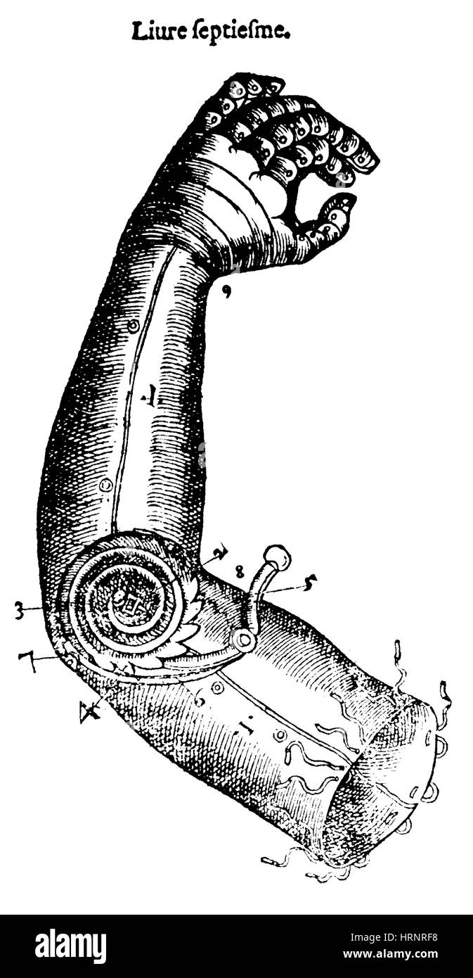 Artificial Arm Designed by Ambroise ParÌ©, 1564 Stock Photo
