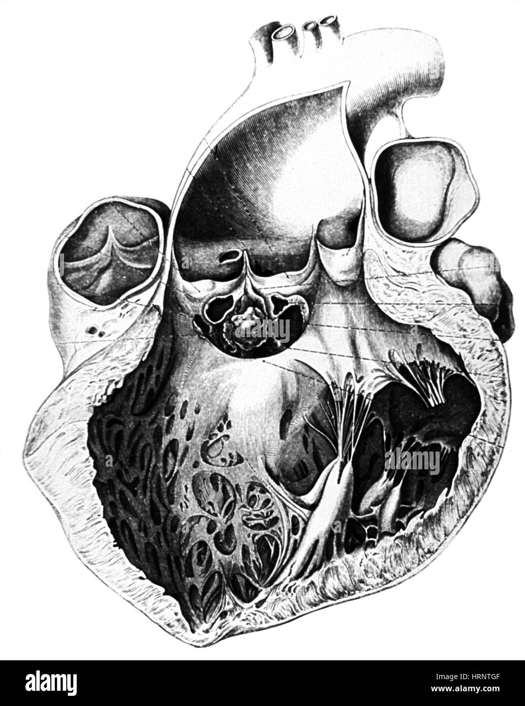 Heart Anatomy, Carl von Rokitansky, 1875 Stock Photo