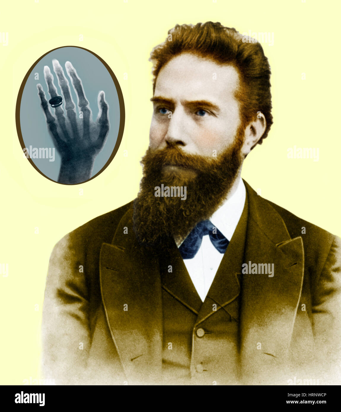 Wilhelm Roentgen, German Physicist Stock Photo