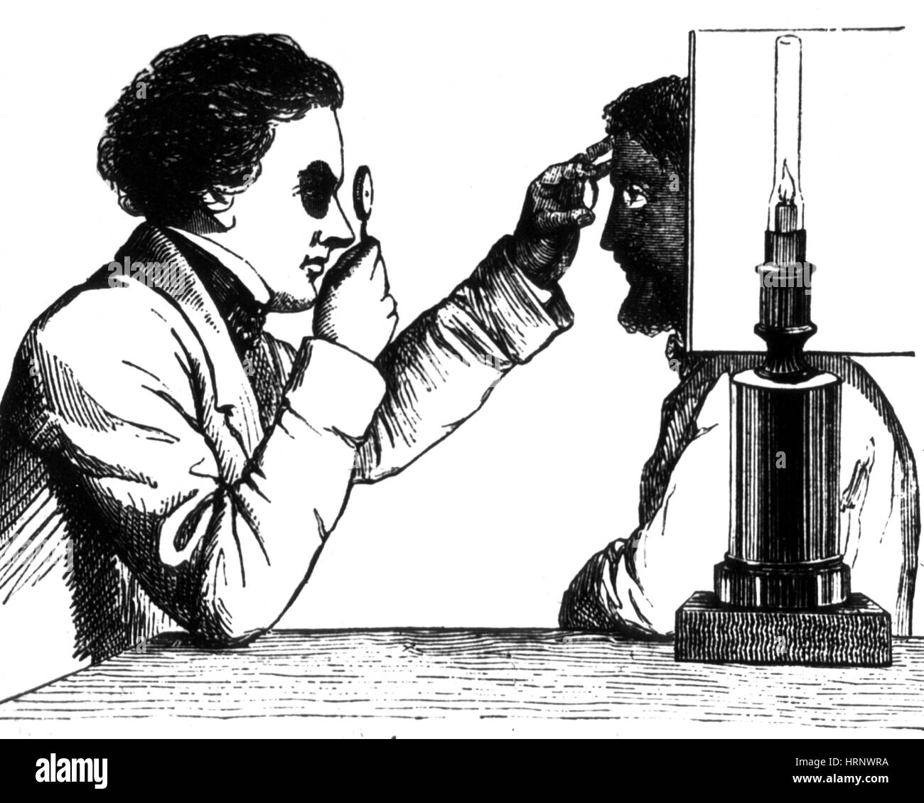 Early Ophthalmoscope, 1873 Stock Photo