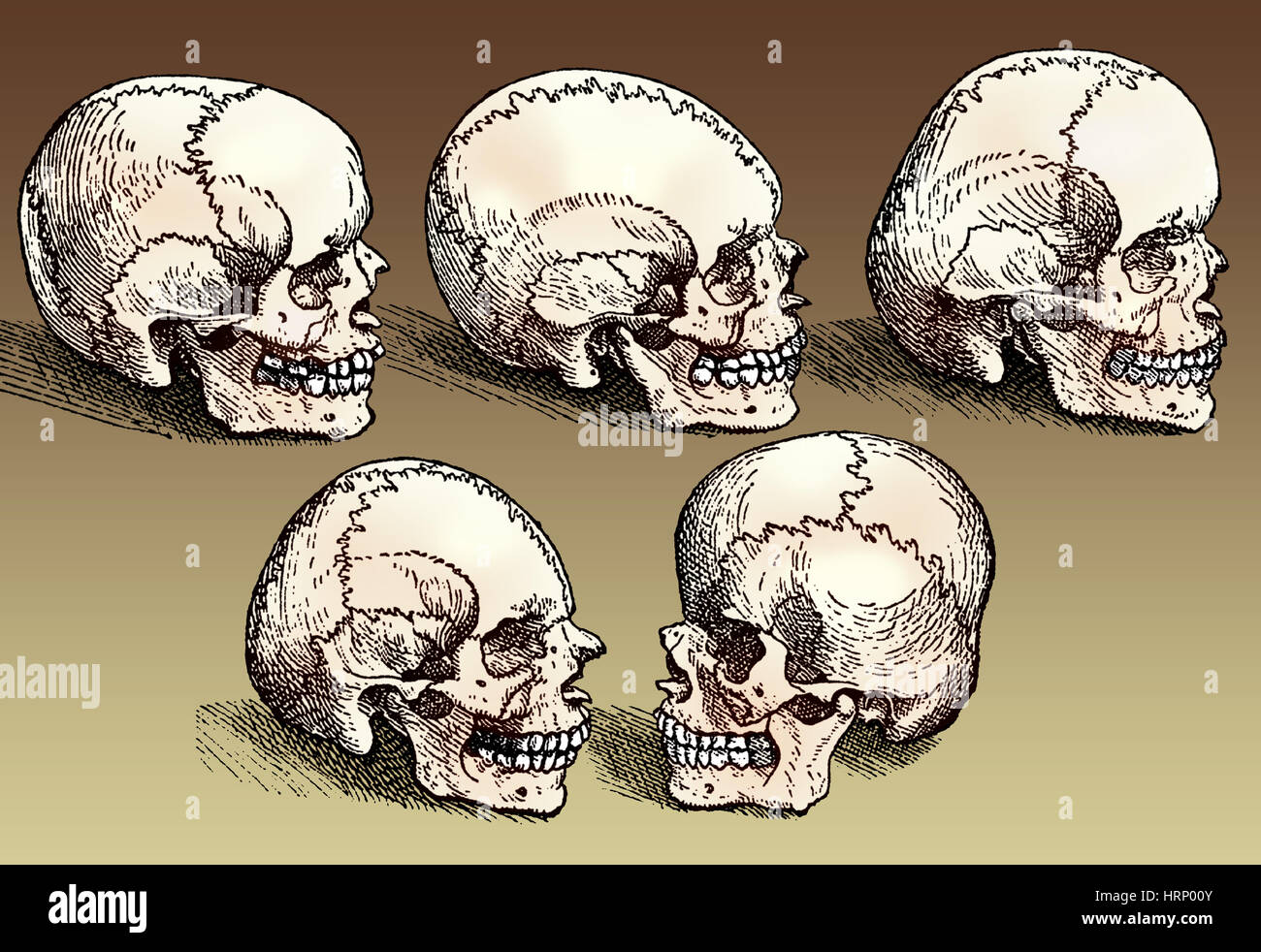 Deformed skulls hi-res stock photography and images - Alamy