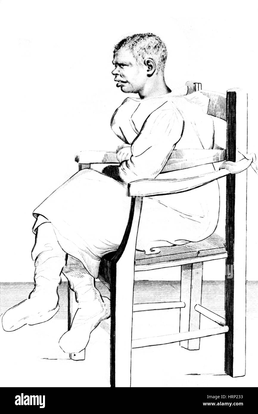 Esquirol Patient, Straitjacket, 1838 Stock Photo