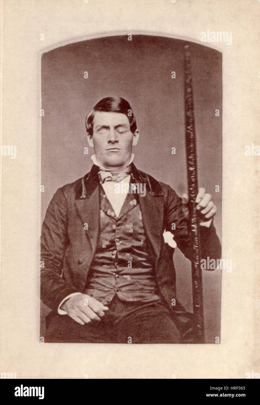 Phineas P. Gage, 1823-1860 Stock Photo