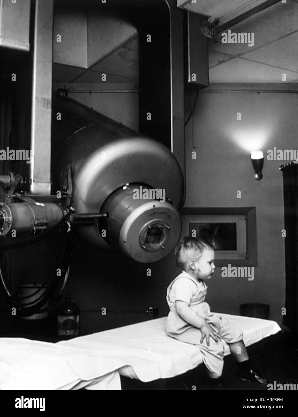 Radiation Therapy for Retinoblastoma, 1957 Stock Photo