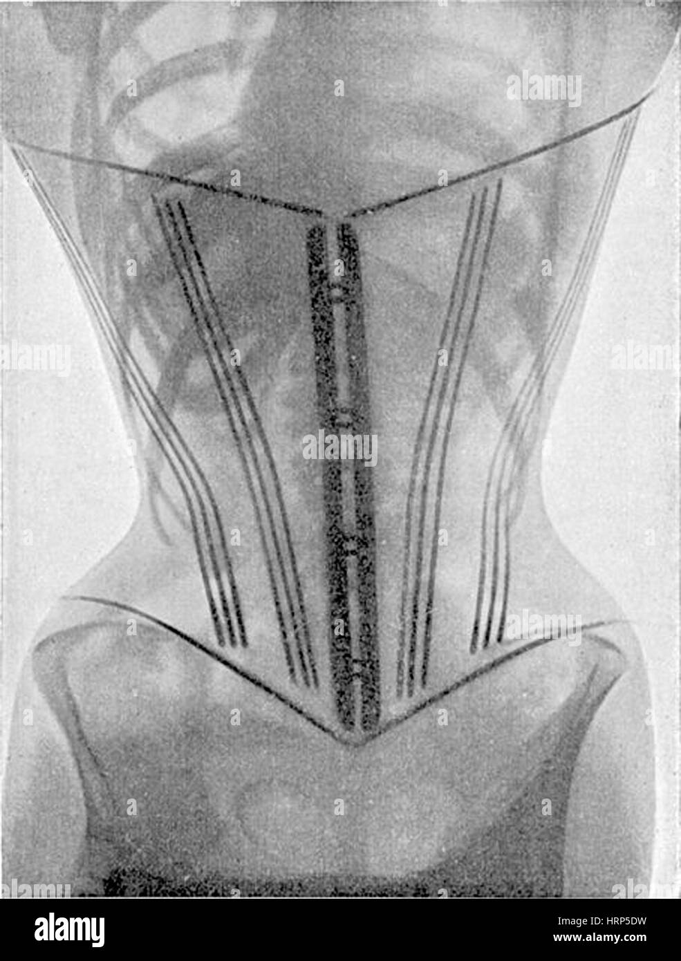 Corset historical Black and White Stock Photos & Images - Alamy