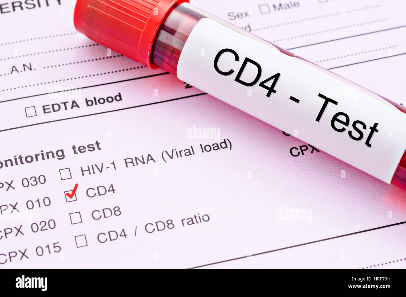 Red Mark And Blood Sample In Tube For Cd4 Cell Testing Immunology Cell In Hiv Infected People On Request Form Background Stock Photo Alamy
