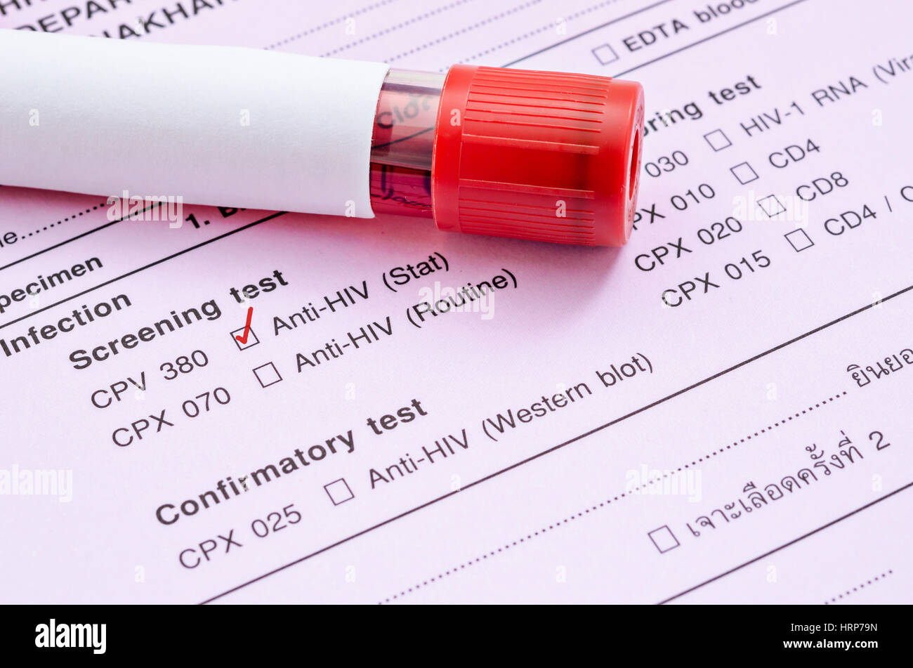Sample blood collection tube with HIV test label on HIV infection