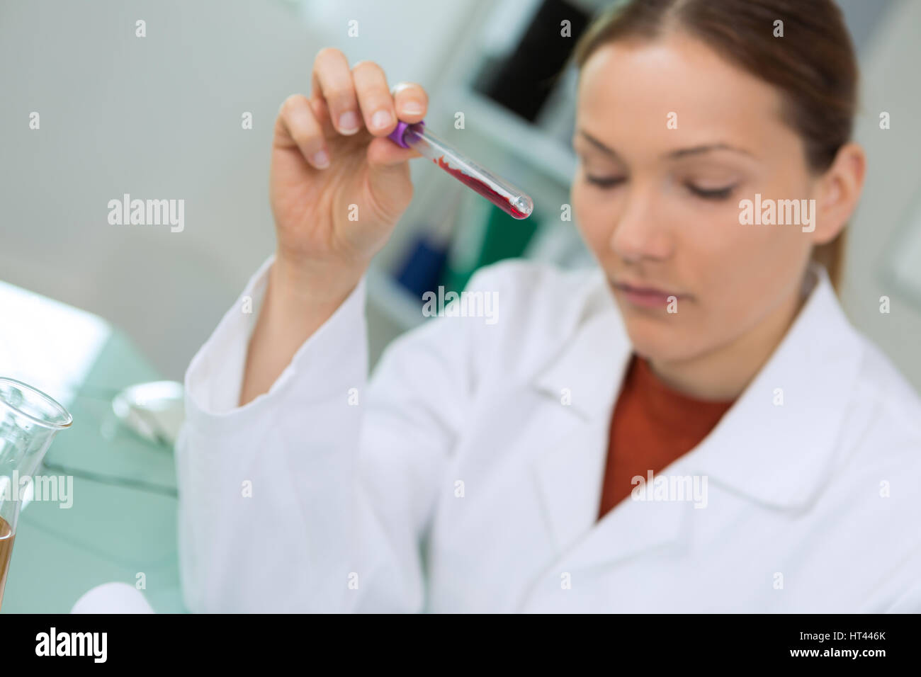 amount of blood sample Stock Photo Alamy