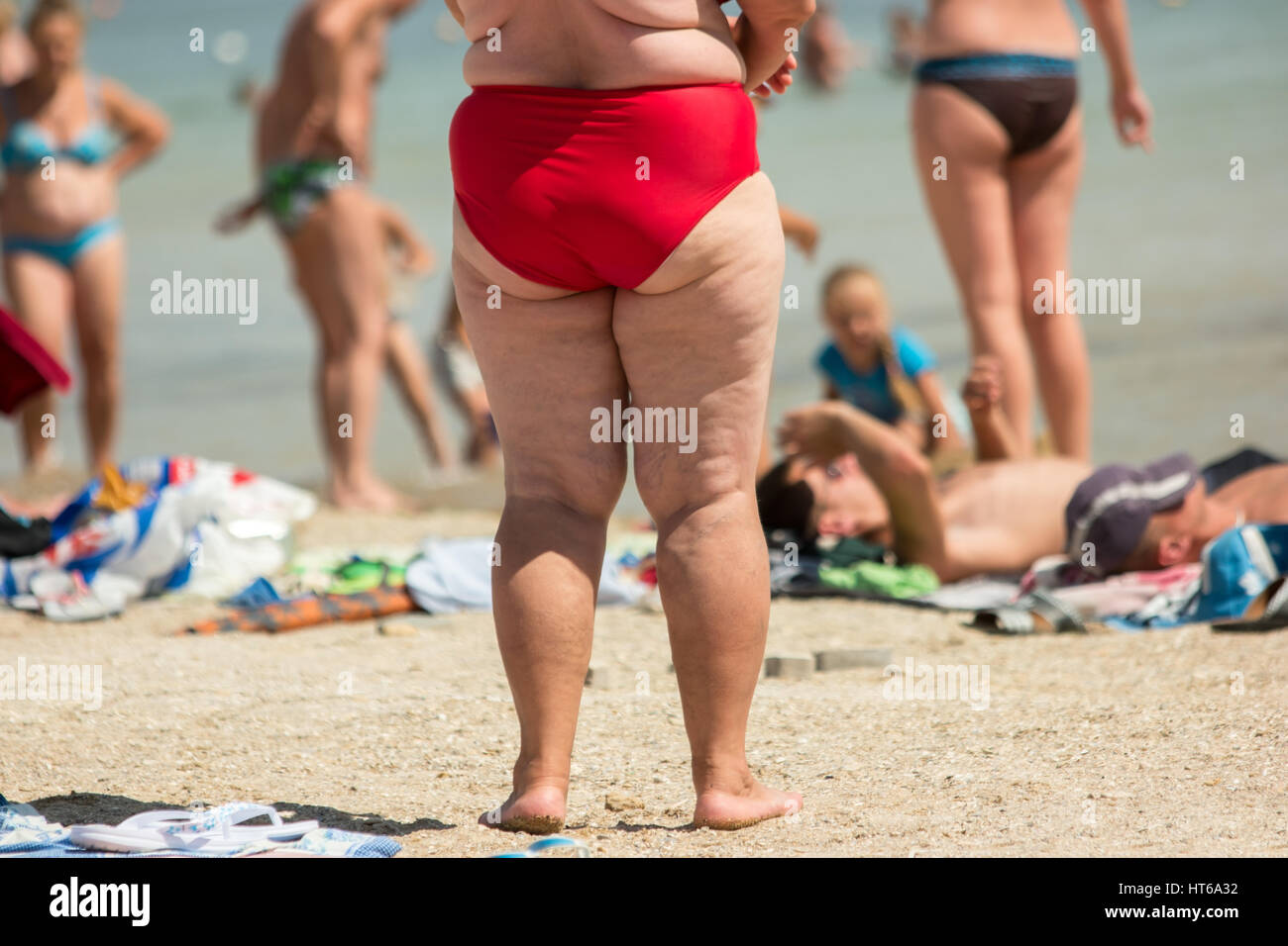 Legs of an obese woman. Overweight lady on the beach. Effect of ...