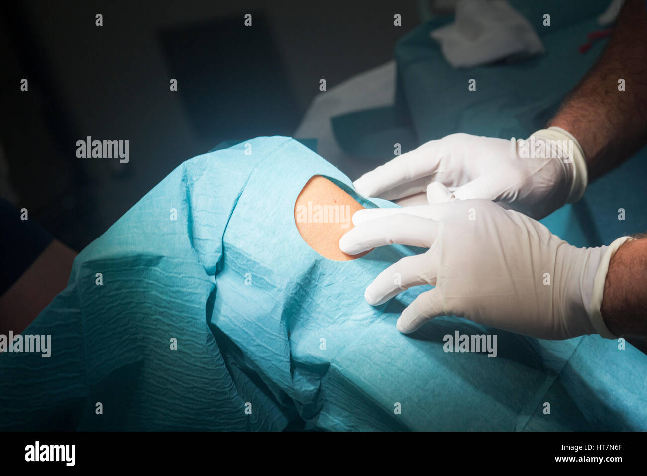 Preparing knee for surgery hospital operation medical procedure in emergency room operating theater. Stock Photo