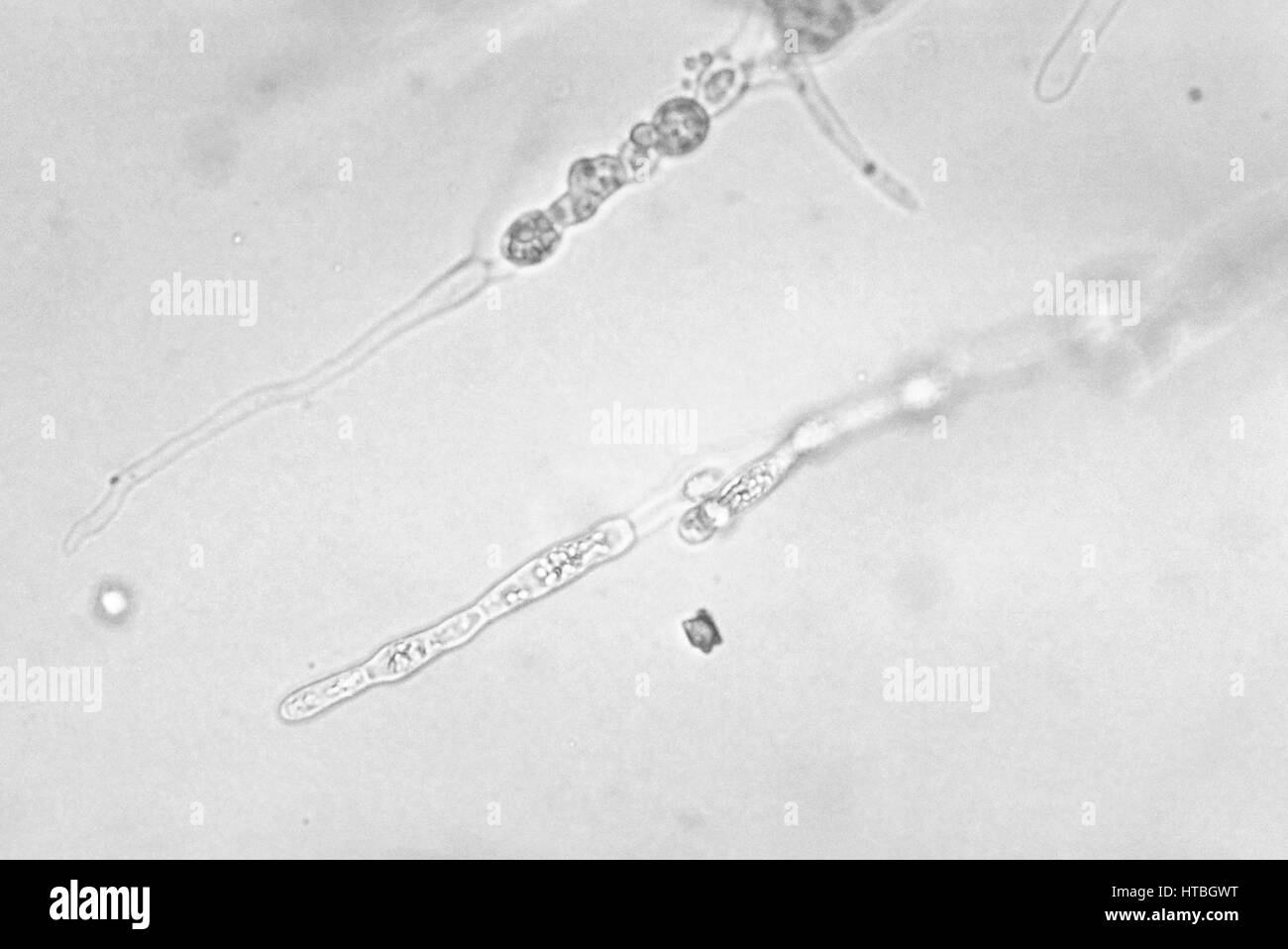 Algae Prototheca filamenta, which resembles a fungal organism due to its mycelia-like filaments, 1973. Image courtesy CDC/Dr. Libero Ajello. Stock Photo