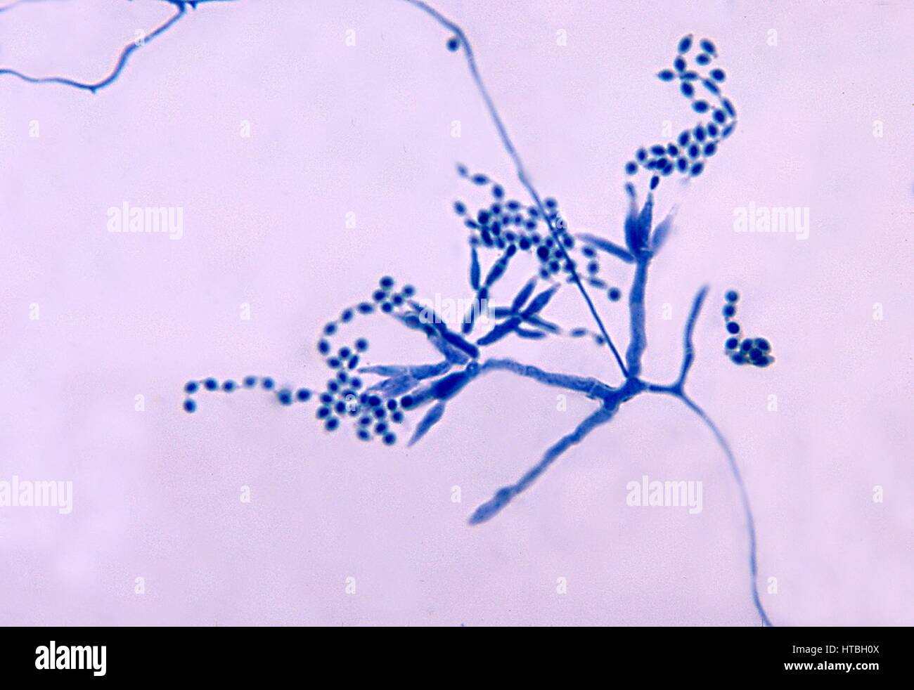 Micrograph of conidia-laden conidiophores and phialides of a Penicillium marneffei fungal organism, 1972. Image courtesy CDC/Dr. Libero Ajello. Stock Photo