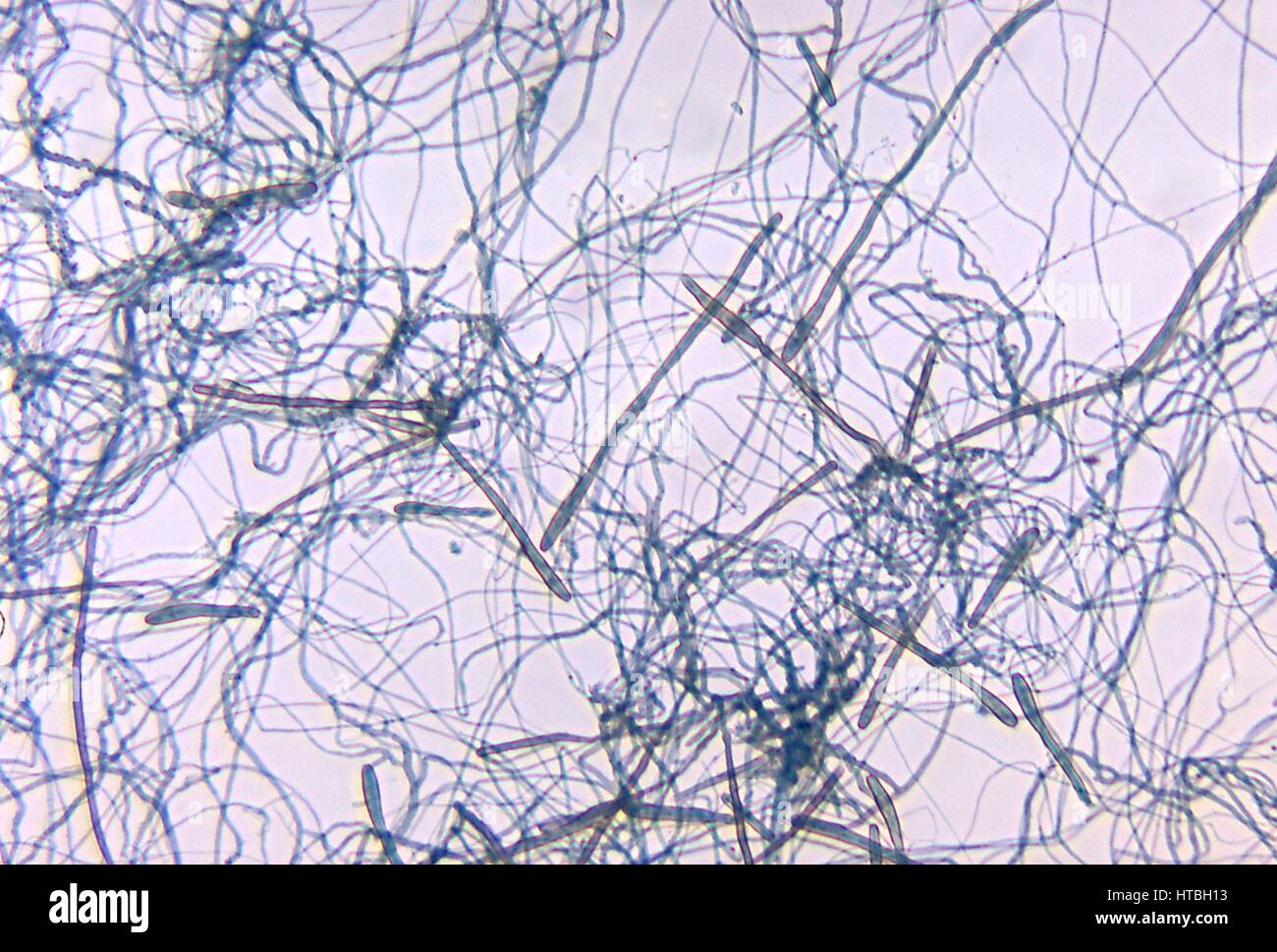 Slide culture photomicrograph of the fungal organism Corynespora cassiicola, the cause of Corynespora Leaf Spot disease in plants, 1972. Image courtesy CDC/Dr. Libero Ajello. Stock Photo