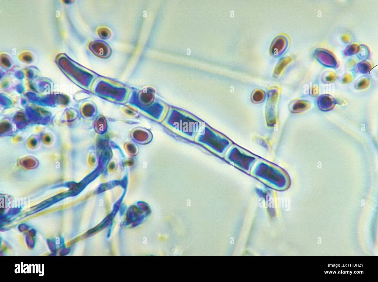 Micrograph of a macroconidium and some microconidia of the fungus Trichophyton rubrum var, 1973. rodhaini. Image courtesy CDC/Dr. Libero Ajello. Stock Photo