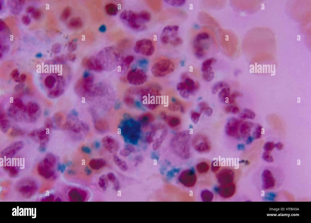 Bone marrow smear photomicrograph of normal iron stores, prepared with Prussian blue stain, 1972