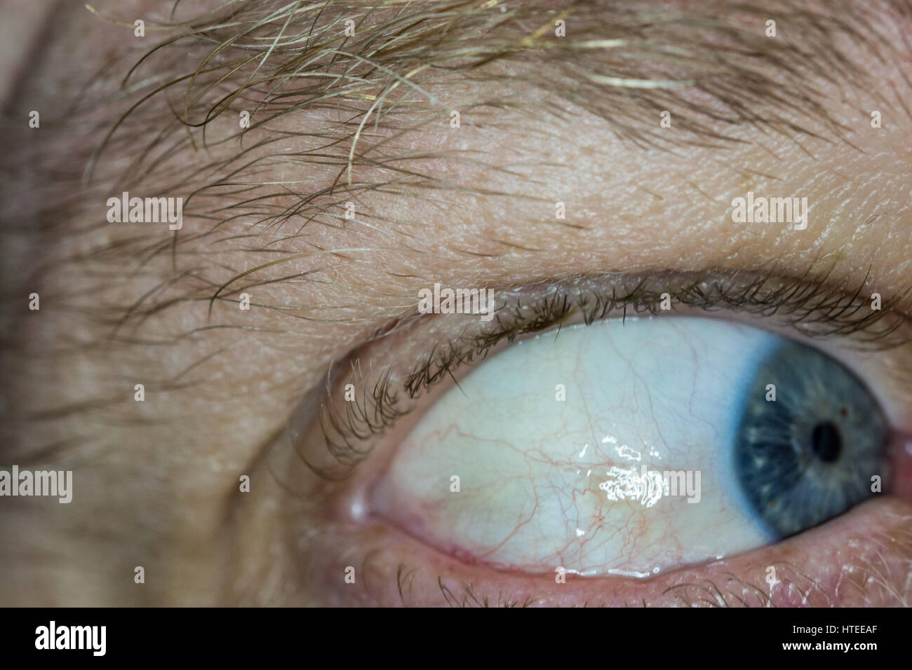 staring at the sun damage staring at the sun damage