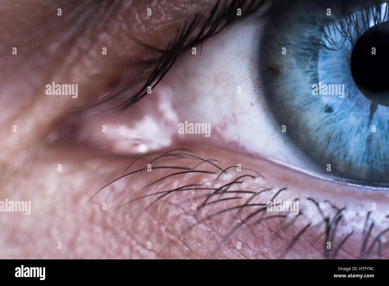 Close up of an eye with veins Stock Photo Alamy