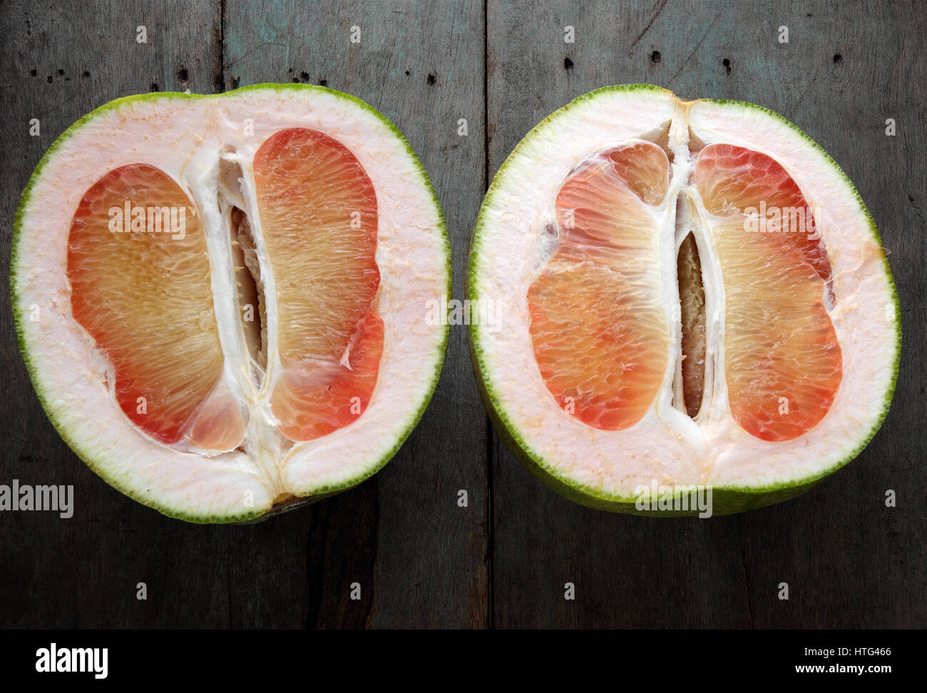 Prevent kidney stones hires stock photography and images Alamy