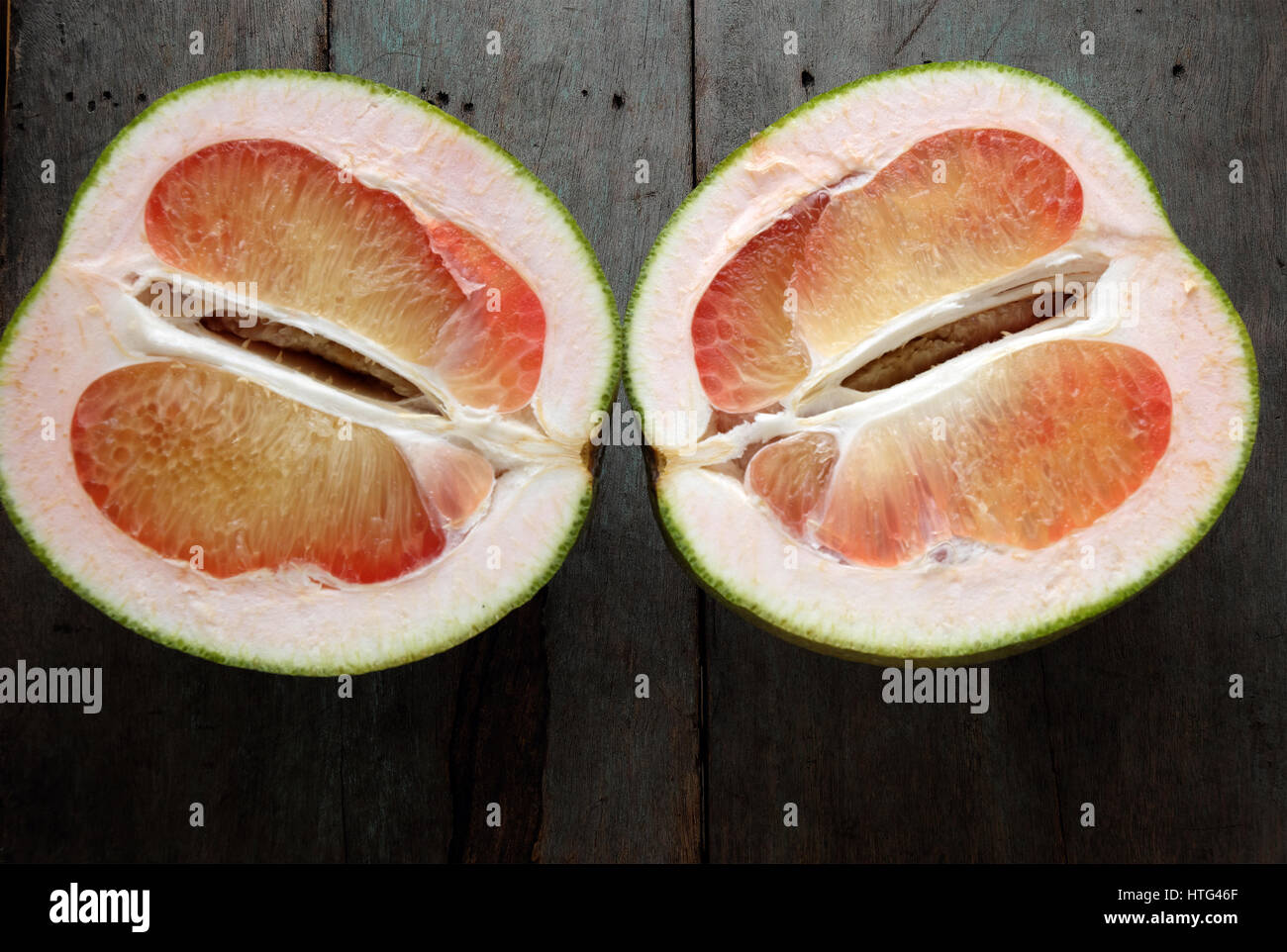 Prevent kidney stones hires stock photography and images Alamy