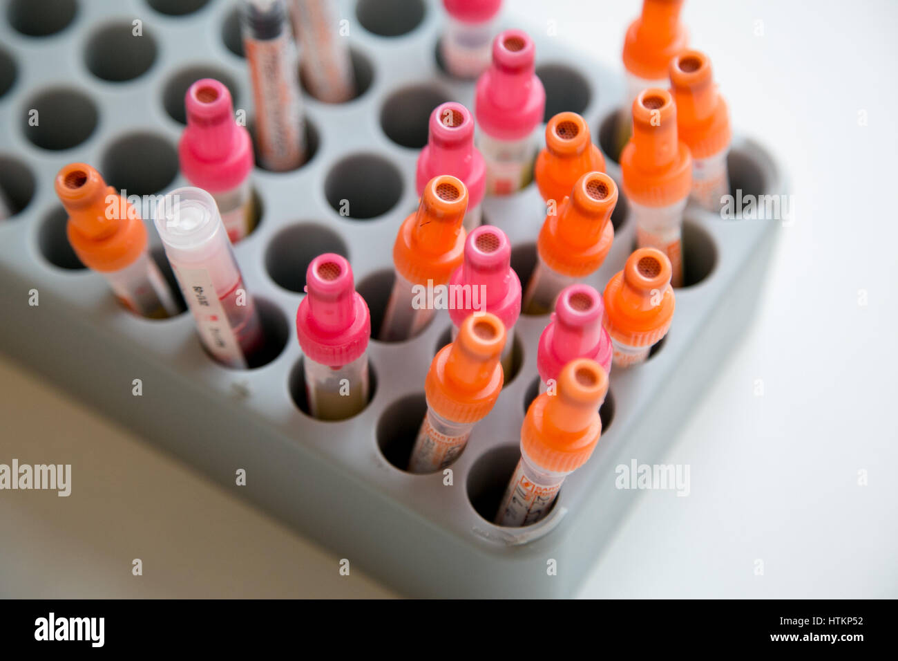 Blood samples awaiting testing Stock Photo