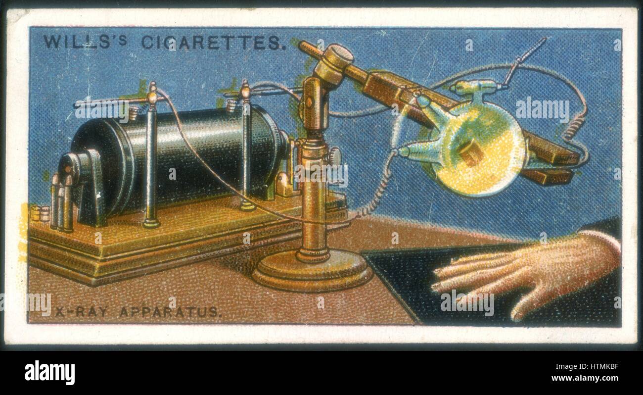 X-ray apparatus powered by a Ruhmkorff coil being used to take an X-ray of a hand. Card published 1915. Chromolithograph Stock Photo