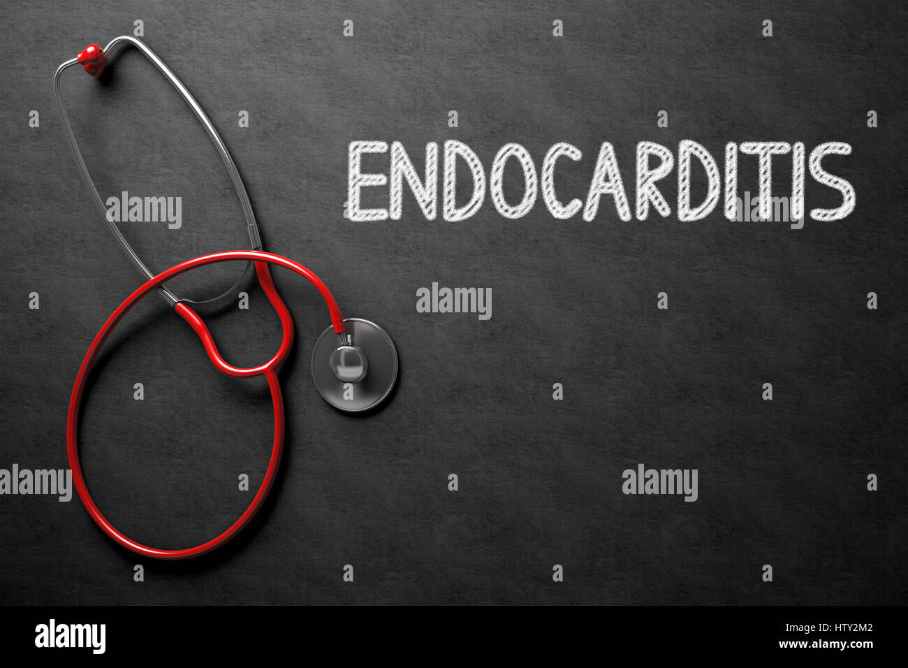 Chalkboard with Endocarditis. 3D Illustration. Stock Photo
