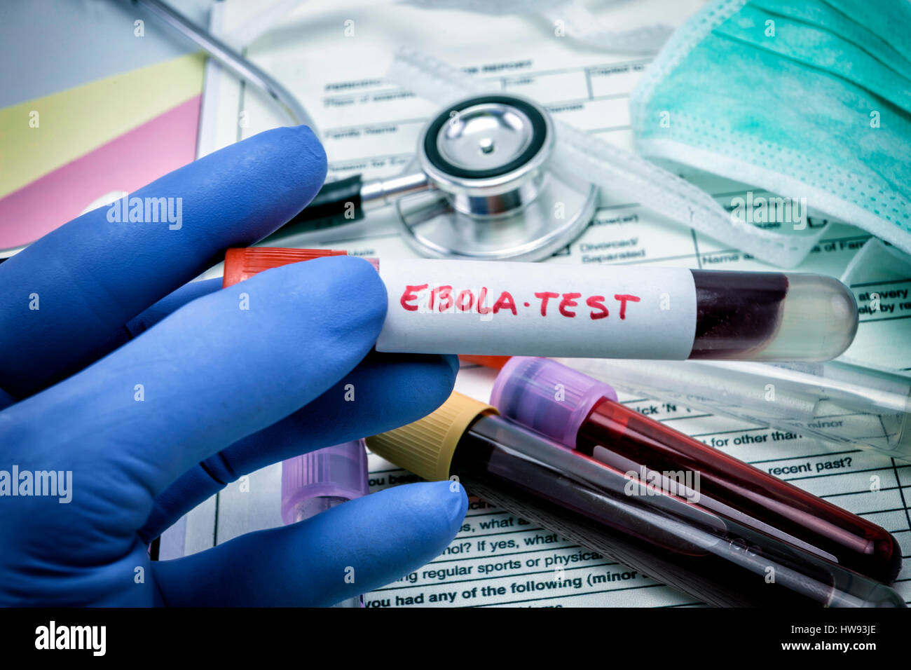 Tests For Research Of Ebola virus, concept healtcare Stock Photo
