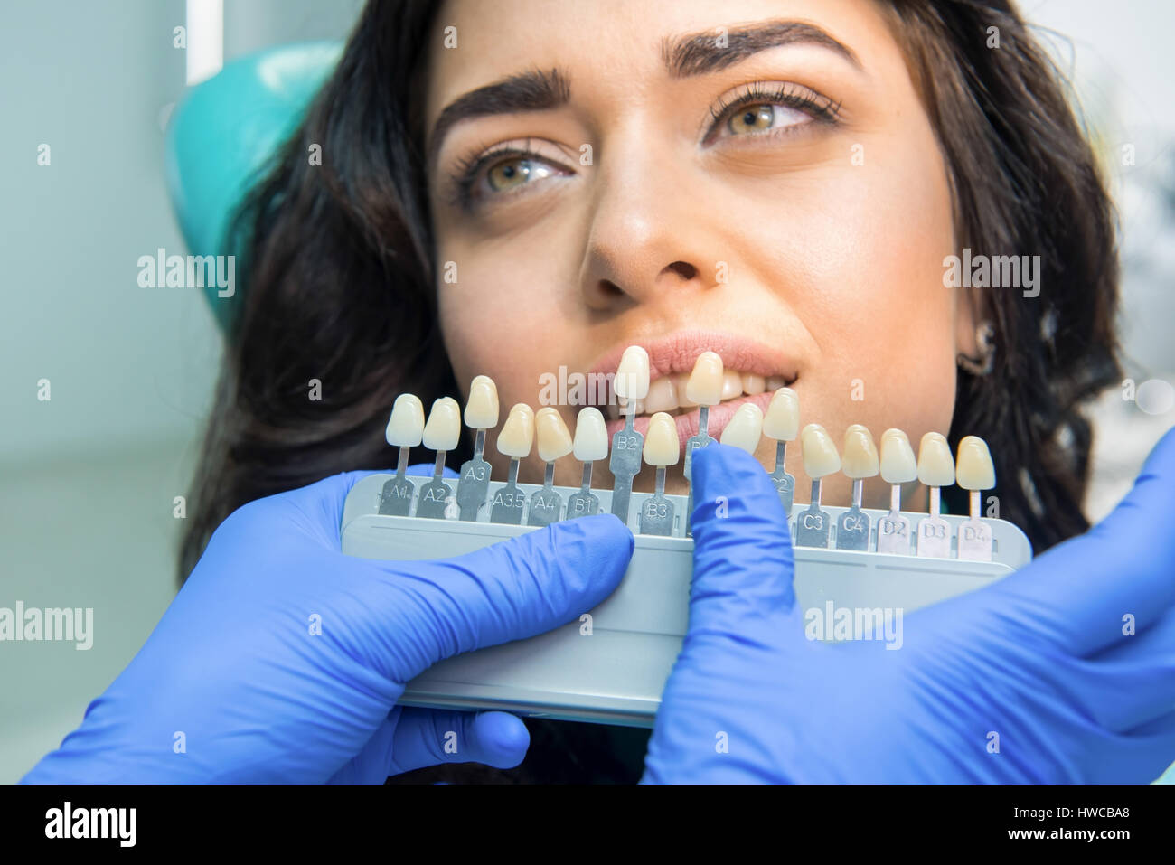 Teeth color chart Stock Photo Alamy