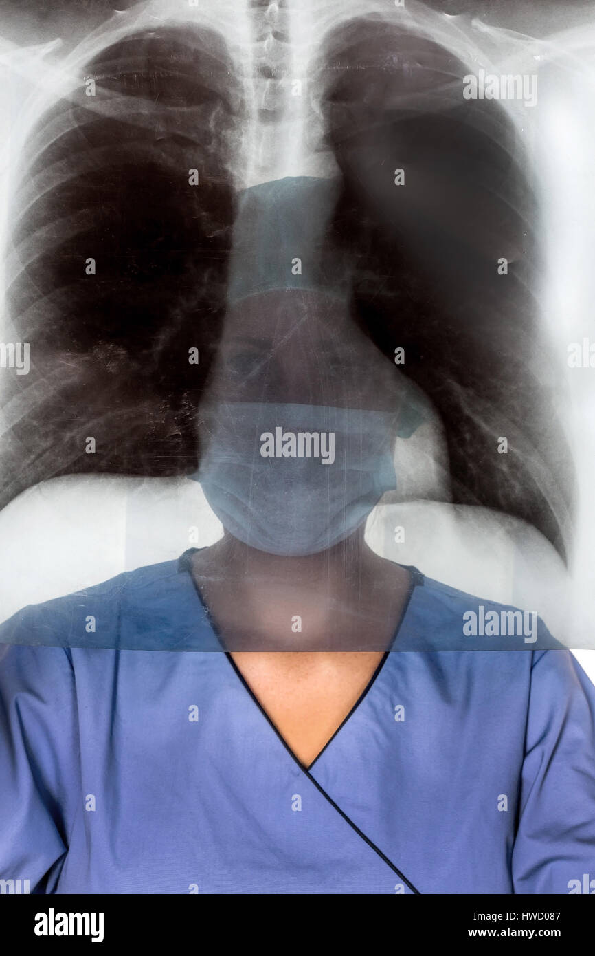 A nurse or doctor in clothes OP before an operation. Symbolic photo for work in the hospital, Eine Krankenschwester oder Aerztin in OP Kleidung vor ei Stock Photo