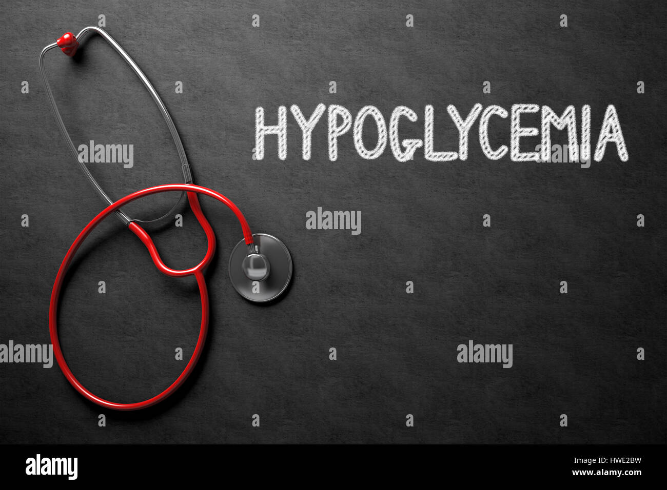 Hypoglycemia Handwritten on Chalkboard. 3D Illustration. Stock Photo