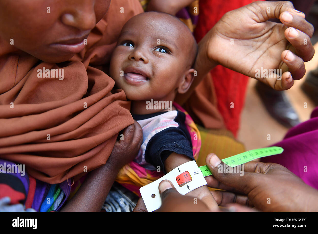 (170321) -- DOOLOW (SOMALIA), March 21, 2017 (Xinhua) -- An acute malnourished child is measured the arm perimeter by a UNICEF staff inside the IDP camp in Doolow, a border town with Ethiopia, in Somalia, on March 20, 2017. One out of seven Somali children dies before its fifth birthday, and acute malnutrition weakens the immune system, which makes affected children more susceptible to disease such as measles, a UN spokesman told reporters earlier this month. In Somalia, drought conditions are threatening an already fragile population battered by decades of conflict. Almost half the population Stock Photo